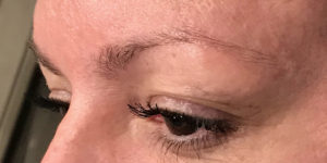 Over-Plucked Eyebrows Issues DFW