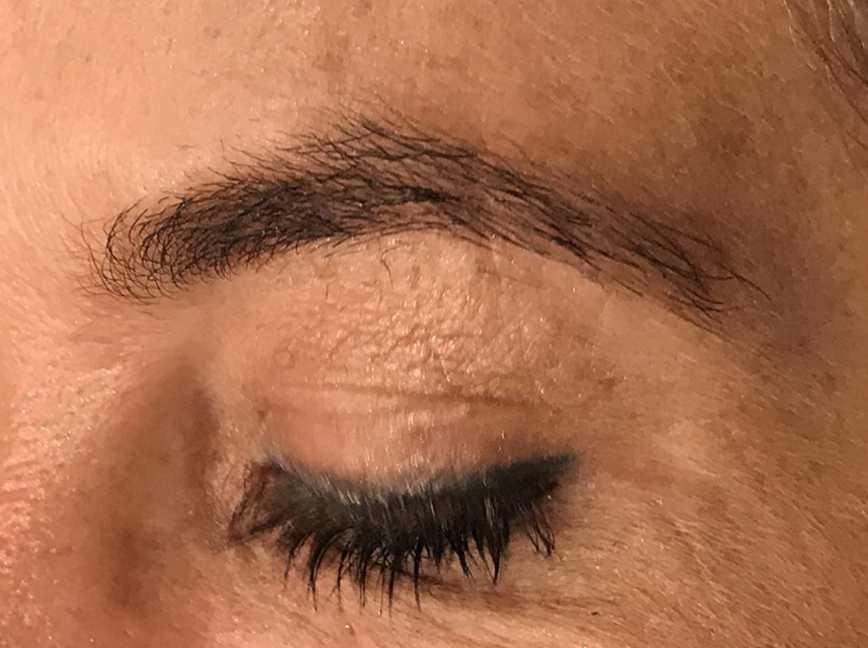 Over-Plucked Eyebrows Issues Plano