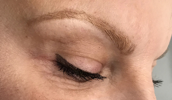 After Microblading
