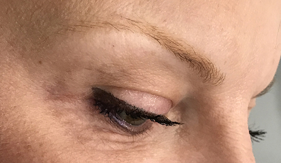 Before Microblading
